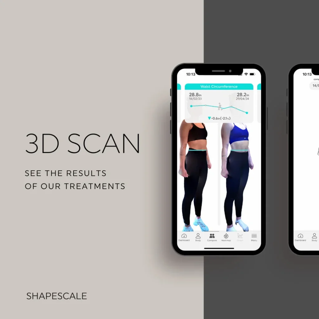ShapeScale 3D body composition scanner at Roseville Trim & Slim in Roseville, California, used for weight loss tracking, body measurements, and progress monitoring.
